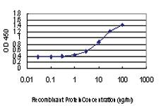 Anti-EPM2A Mouse Monoclonal Antibody [clone: 6C6]