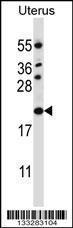 Anti-CDKN1B Rabbit Polyclonal Antibody (FITC (Fluorescein Isothiocyanate))