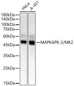 Western blot analysis of extracts of various lysates, using Anti-MK2 Antibody [ARC55427] (A307504) at 1:2,000 dilution The secondary antibody was Goat Anti-Rabbit IgG H&L Antibody (HRP) at 1:10,000 dilution Lysates/proteins were present at 25 µg per lane