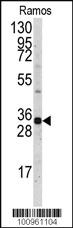 Anti-MCL1 Rabbit Polyclonal Antibody