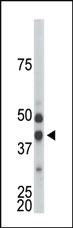 Anti-CDKL1 Rabbit Polyclonal Antibody