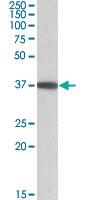 Anti-MOGAT2 Goat Polyclonal Antibody