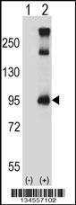 Anti-TRPC3 Rabbit Polyclonal Antibody (PE (Phycoerythrin))