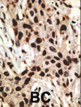 Anti-MCL1 Rabbit Polyclonal Antibody