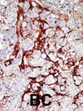 Anti-CDKL1 Rabbit Polyclonal Antibody