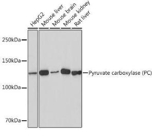 Western blot analysis of extracts of various cell lines, using Anti-PCB Antibody [ARC1371] (A307505) at 1:1,000 dilution The secondary antibody was Goat Anti-Rabbit IgG H&L Antibody (HRP) at 1:10,000 dilution Lysates/proteins were present at 25 µg per lane