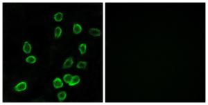 Immunofluorescence analysis of A549 cells using Anti-ATP5G3 Antibody. The right hand panel represents a negative control, where the antibody was pre-incubated with the immunising peptide.