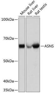 Anti-Asparagine synthetase antibody