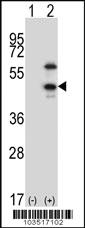 Anti-CDKL1 Rabbit Polyclonal Antibody