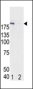 Anti-EGFR Rabbit Polyclonal Antibody (HRP (Horseradish Peroxidase))