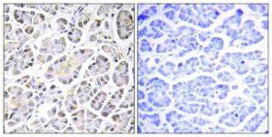 Immunohistochemical analysis of paraffin-embedded human pancreas tissue using Anti-ATP5G3 Antibody. The right hand panel represents a negative control, where the antibody was pre-incubated with the immunising peptide.