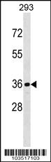 Anti-CDKL1 Rabbit Polyclonal Antibody