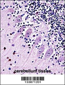 Anti-TRPC5 Rabbit Polyclonal Antibody (APC (Allophycocyanin))