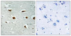 Immunohistochemical analysis of paraffin-embedded human brain tissue using Anti-4E-BP1 Antibody. The right hand panel represents a negative control, where the Antibody was pre-incubated with the immunising peptide