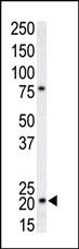 Anti-p21 (CDKN1A) Rabbit Polyclonal Antibody