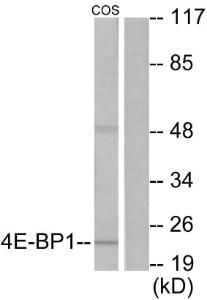 Western blot analysis of lysates from COS7 cells, treated with EGF 200 ng/ml 30' using Anti-4E-BP1 Antibody. The right hand lane represents a negative control, where the Antibody is blocked by the immunising peptide