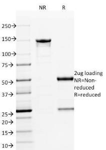 SDS-PAGE analysis of Anti-ETS1 Antibody [ETS1/1801] under non-reduced and reduced conditions; showing intact IgG and intact heavy and light chains, respectively SDS-PAGE analysis confirms the integrity and purity of the antibody