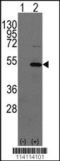 Anti-YBX1 Rabbit Polyclonal Antibody