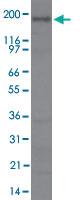 Anti-RICTOR Rabbit Polyclonal Antibody