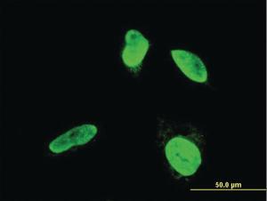 Anti-TESK2 Mouse Monoclonal Antibody [clone: 5H4]