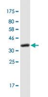 Anti-RPGRIP1 Mouse Monoclonal Antibody [clone: 5H2]