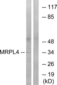 Western blot analysis of lysates from COLO cells using Anti-MRPL4 Antibody. The right hand lane represents a negative control, where the Antibody is blocked by the immunising peptide