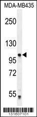 Anti-PCDHA5 Rabbit Polyclonal Antibody (HRP (Horseradish Peroxidase))