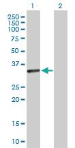 Anti-CENPP Rabbit Polyclonal Antibody