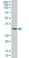 Anti-RNF2 Mouse Monoclonal Antibody [clone: 4A12]