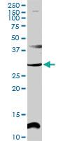 Anti-CENPP Rabbit Polyclonal Antibody