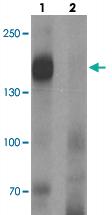 Anti-LNPEP Rabbit Polyclonal Antibody