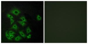 Anti-EDG8 antibody