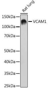 Western blot analysis of extracts of Rat lung, using Anti-VCAM1 Antibody [ARC0312] (A305813) at 1:1000 dilution