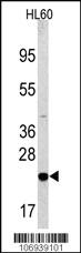 Anti-SPDYE1 Rabbit Polyclonal Antibody [clone: 167CT22.1.6]