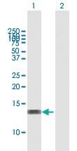 Anti-RBBP6 Mouse Polyclonal Antibody