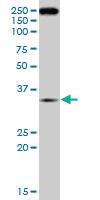 Anti-RNF2 Mouse Monoclonal Antibody [clone: 4A12]