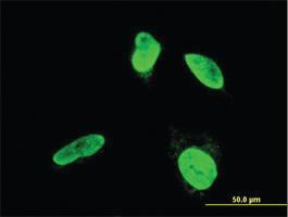 Anti-TESK2 Mouse Monoclonal Antibody [clone: 5H4]