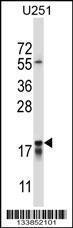 Anti-CTAG2 Rabbit Polyclonal Antibody (Biotin)