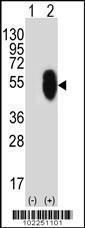 Anti-MLLT6 Rabbit Polyclonal Antibody (AP (Alkaline Phosphatase))