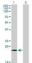 Anti-COX4I1 Mouse Monoclonal Antibody [clone: 4A10]