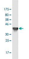 Anti-NHS Mouse Monoclonal Antibody [clone: 6D9]