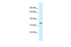 Anti-MRPL1 Rabbit Polyclonal Antibody