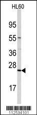 Anti-TRAPPC4 Rabbit Polyclonal Antibody (Biotin)