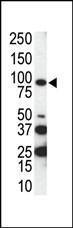 Anti-AXL Rabbit Polyclonal Antibody (AP (Alkaline Phosphatase))