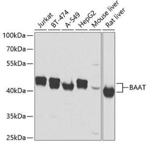 Western blot analysis of extracts of various cell lines, using Anti-BAAT Antibody (A10180) at 1:2,000 dilution