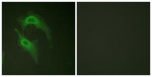 Immunofluorescence analysis of HeLa cells using Anti-CD226 Antibody. The right hand panel represents a negative control, where the antibody was pre-incubated with the immunising peptide.