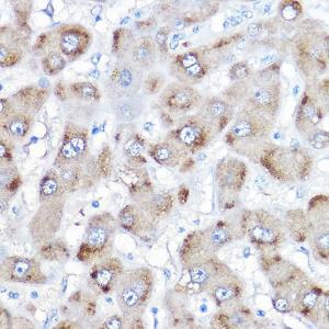 Immunohistochemistry analysis of paraffin-embedded human liver using Anti-BAAT Antibody (A10180) at a dilution of 1:500 (40X lens). Perform high pressure antigen retrieval with 10 mM citrate buffer pH 6.0 before commencing with IHC staining protocol