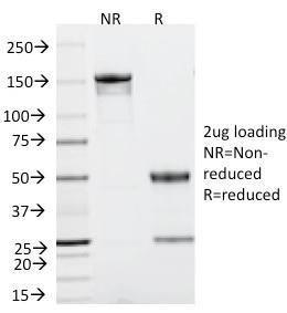 SDS-PAGE analysis of Anti-p53 Antibody [TRP/816] under non-reduced and reduced conditions; showing intact IgG and intact heavy and light chains, respectively. SDS-PAGE analysis confirms the integrity and purity of the antibody.