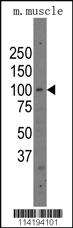 Anti-PARP12 Rabbit Polyclonal Antibody