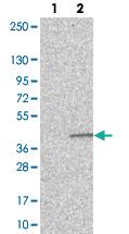 Anti-SLC30A7 Rabbit Polyclonal Antibody